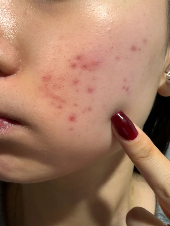 没换了？这种毛巾建议马上换掉AG真人国际你家的毛巾多久(图14)